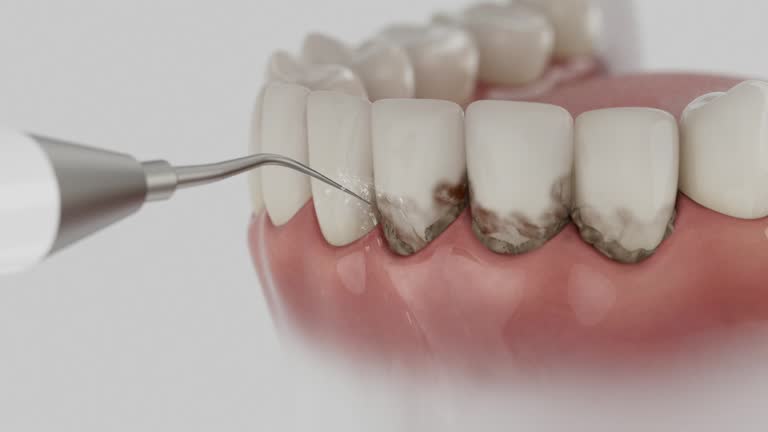 Trusted Tooth Extraction service in Augusta, GA - Dentist Open Now